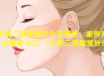 大同二院除皱针价目揭秘，案例对比惊艳 🦉 「大同二院除皱针价目揭秘,案例对比惊艳」